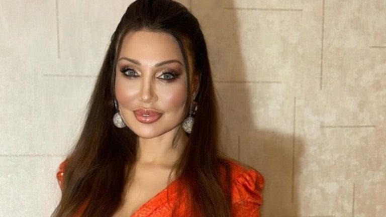 Alın daraltma estetiği yaptıran Umut Akyürek imaj yeniledi! Alın daraltma estetiği yaptıran Umut Akyürek imaj yeniledi!