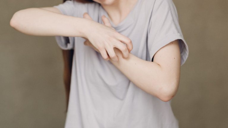 Uyuz salgınına dikkat! Tedavi edilmezse ilerleyebilir.. Uyuz salgınına dikkat! Tedavi edilmezse ilerleyebilir..