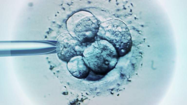 Kısırlık Tedavisi Hakkında Bilinmesi Gerekenler Kısırlık Tedavisi Hakkında Bilinmesi Gerekenler